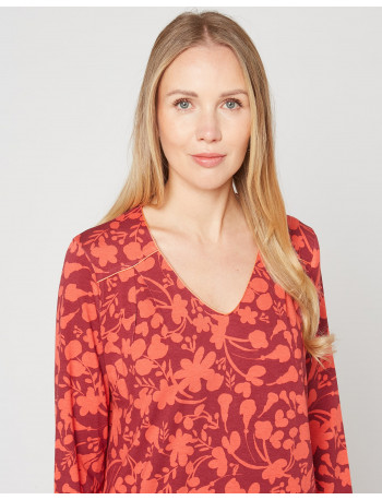 button mini dress